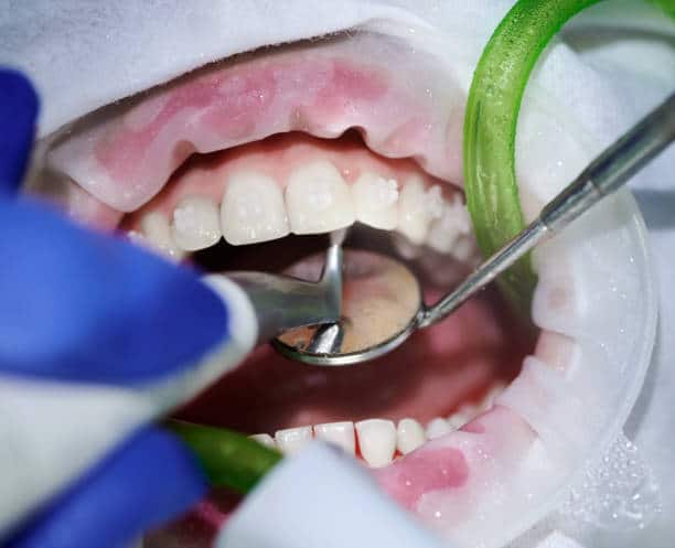 smaltimento rifiuti dentisti